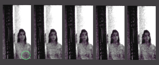 Ecto-shunt progression II.bmp