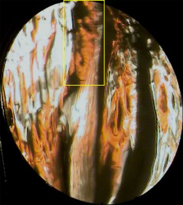 Jan14 mix 37sec man face-crop-hl.jpg